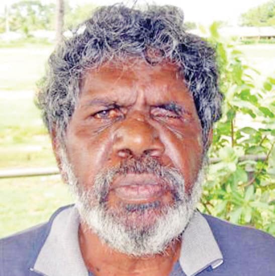 Burt Wikmunea was found safe.